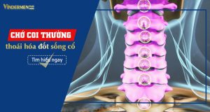 Thoái hóa đốt sống cổ nguy hiểm hơn chúng ta tưởng