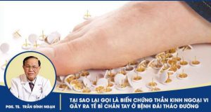 BIẾN CHỨNG THẦN KINH NGOẠI VI GÂY RA TÊ BÌ CHÂN TAY Ở BỆNH ĐÁI THÁO ĐƯỜNG