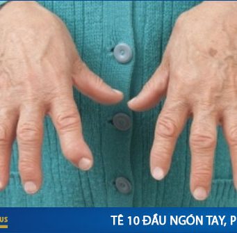 Bị tê 10 đầu ngón tay là bệnh gì ?