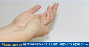 tê ngón tay cái