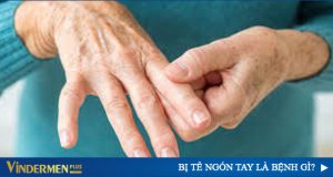 tê ngón tay là bệnh gì