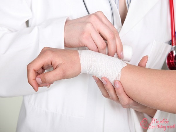 Điều trị hội chứng ống cổ tay sau sinh
