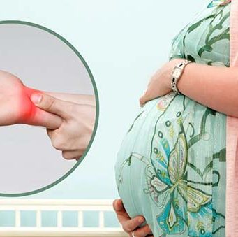 Hội chứng ống cổ tay khi mang thai: Nguyên nhân và cách điều trị